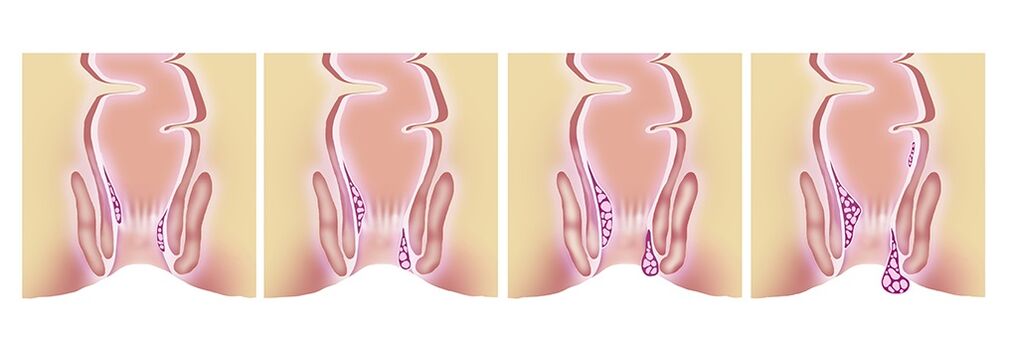 Gelarex efficace dans toutes les phases